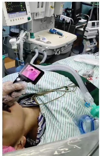 PVL-I-02 初次使用收到麻醉科医生一致好评